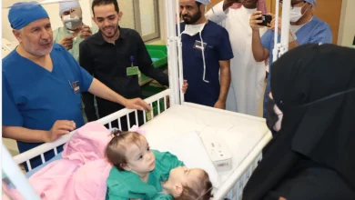 صورة نجاح عملية فصل التوأم الملتصق السوري «سيلين وإيلين»