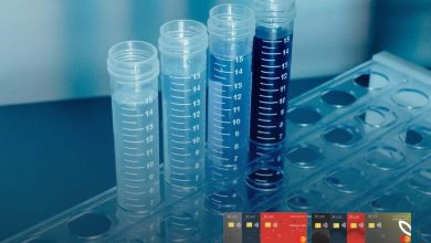 صورة بنك saib يقدّم 30% خصما لعملائه في معامل التحاليل والأشعة