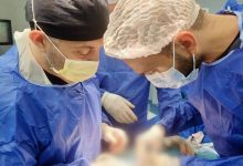 صورة “الرعاية الصحية”: إجراء 135 ألف عملية تدخل جراحي من خلال 7 مستشفيات بمحافظة الإسماعيلية بمعايير عالمية ونِسَب نجاح مرتفعة