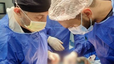 صورة “الرعاية الصحية”: إجراء 135 ألف عملية تدخل جراحي من خلال 7 مستشفيات بمحافظة الإسماعيلية بمعايير عالمية ونِسَب نجاح مرتفعة